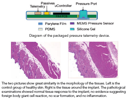 schematic of package layers; L & R tissue slides: Caption 1: Diagram of the packaged pressure telemetry device. Caption 2: The two pictures show great similarity in the morphology of the tissues. Left is the control group of healthy skin. Right is the tissue around the implant. The pathological examinations showed normal tissue response to the implant; no evidence suggesting foreign body giant cell reaction, no scar formation, and no inflammation.