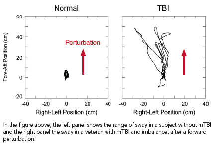 Charts illustrating range of sway in veteran with mTBI and without mTBI 