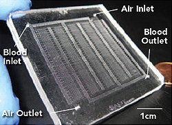 Wireless Implantable Bladder Pressure Monitor for Continence and Urinary Health