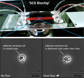 SCD Biochip developed for studying biophysical characteristics of blood cells in sickle cell anemia