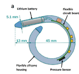 Wireless Implantable Bladder Pressure Monitor for Continence and Urinary Health